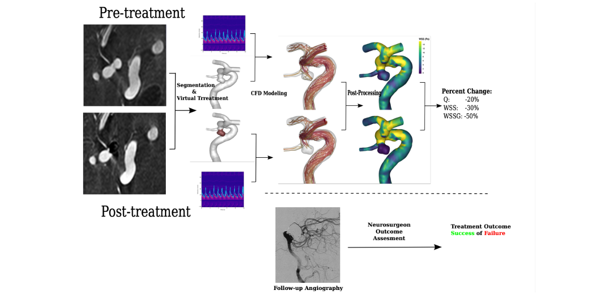 cfd aneurysms